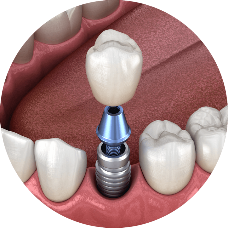 Texas Center for Oral Surgery & Dental Implants Texas