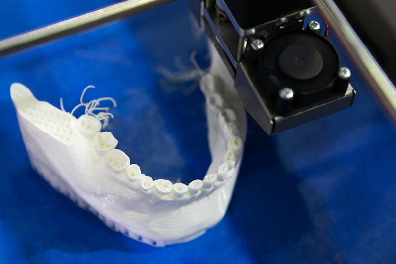 dental 3d printing