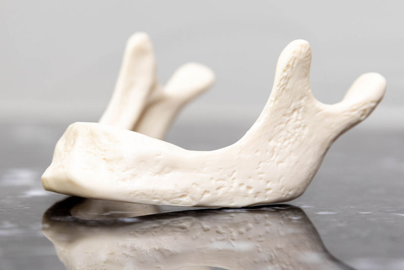 jaw bone model