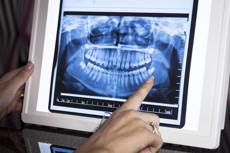 an oral surgeon looking at a dental xray.