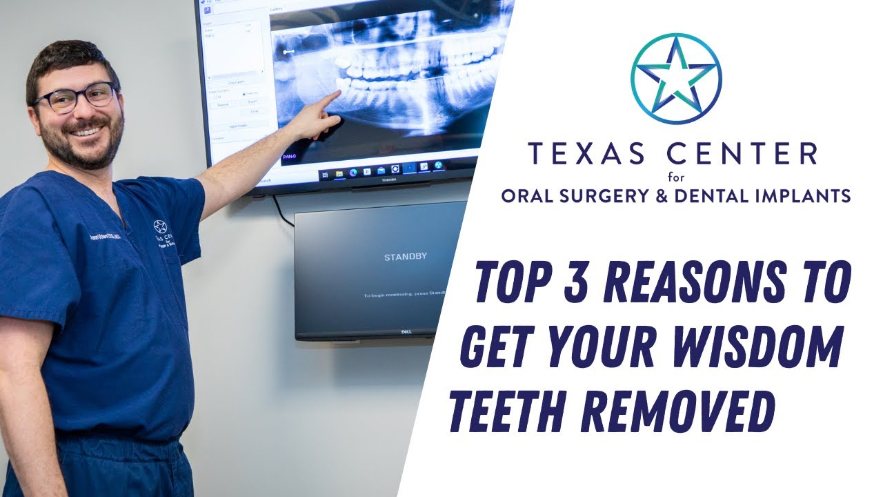 Dr. Vickers Talks About The Top 3 Reasons To Get Your Wisdom Teeth Removed