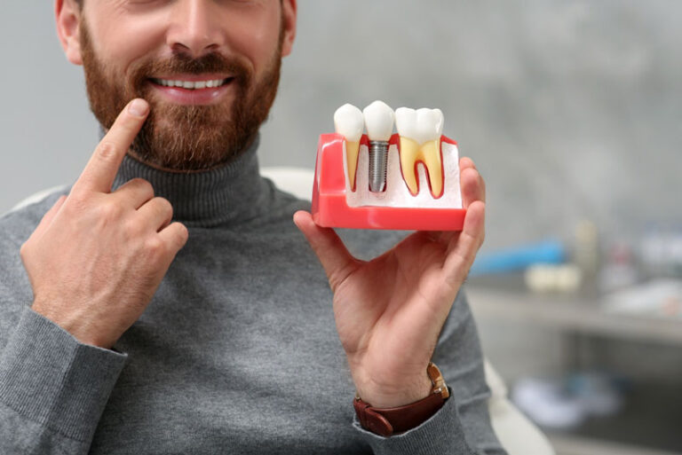 A smiling man with a beard, points to his teeth while holding a dental model showing. The background is blurred, suggesting a dental office setting