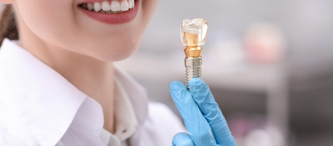 Dentist holding educational model of dental implant indoors, closeup.