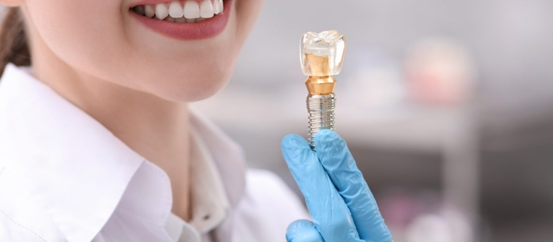 Dentist holding educational model of dental implant indoors, closeup.