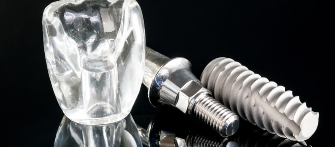 11-24-dental-implant1