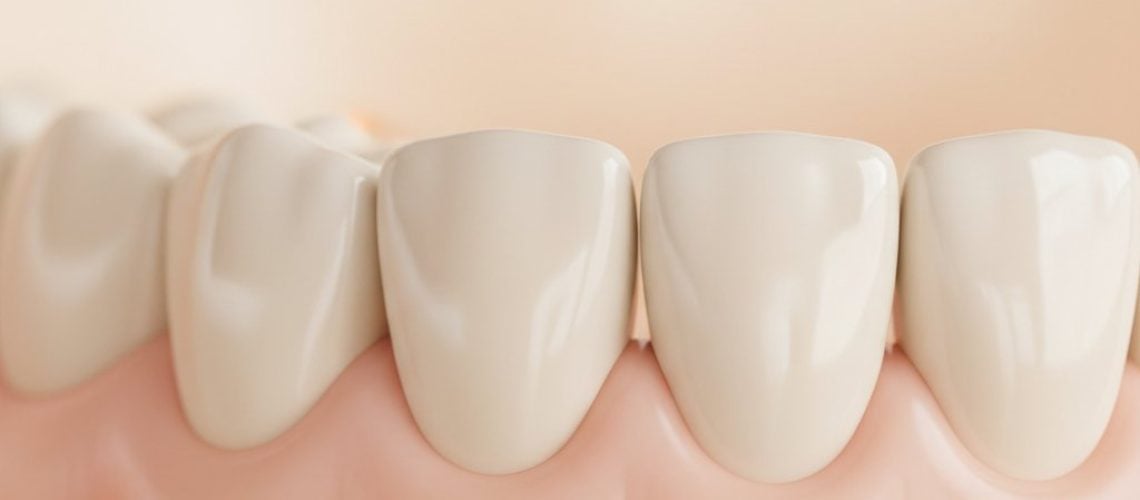 Close-up of dental implant seamlessly in gum line. Natural gums, pearly white crown. Soft lighting, blurred background.