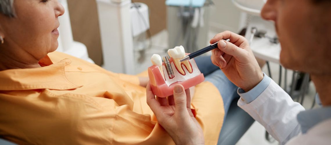 2024-08-Imp2-Closeup-of-male-dentist-holding-tooth-model-while-explaining-dental-implant-surgery-to-patient