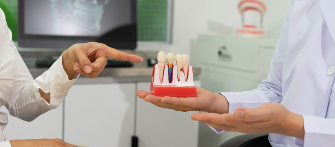 Dentist explains dental implants using model in dental clinic.