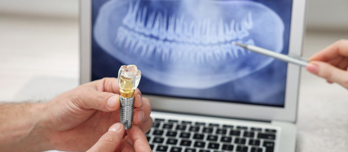 Doctor-showing-patient-X-ray-picture-and-educational-model-of-dental-implant-in-clinic-closeup
