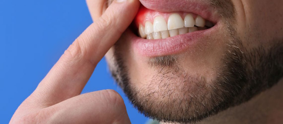 Man-with-gum-inflammation-on-blue-background-closeup