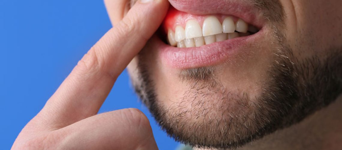 Man-with-gum-inflammation-on-blue-background-closeup