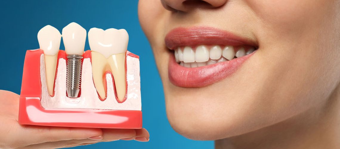 Young-woman-with-beautiful-smile-and-dentist-holding-educational-model-of-dental-implant-on-blue-background-closeup