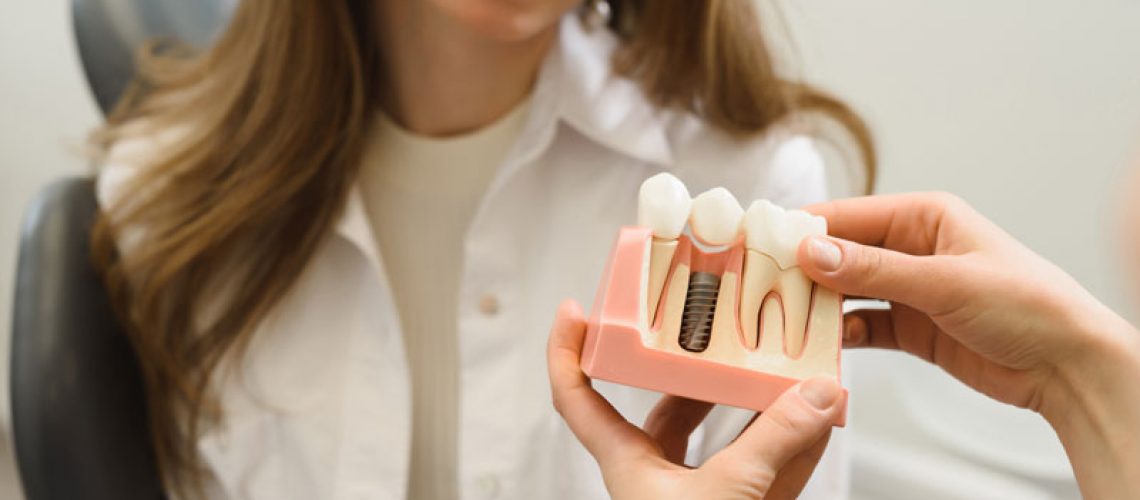 Dental Patient Getting Shown A Dental Implant Model During Her Consultation in Flower Mound, TX