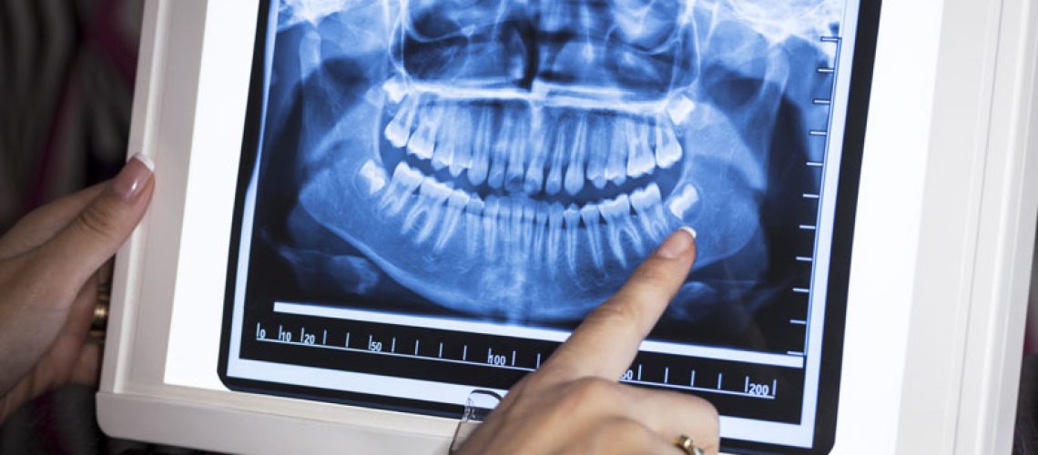 an oral surgeon looking at a dental xray.