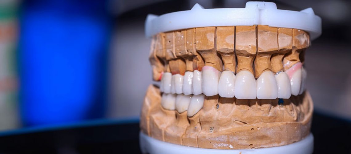 Close up photo of a professional mouth prosthesis model.